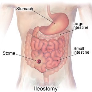 What You Need To Know About Colon Cleanses Before Booking One recommend What You Need To Know About Colon Cleanses Before Booking One forecasting