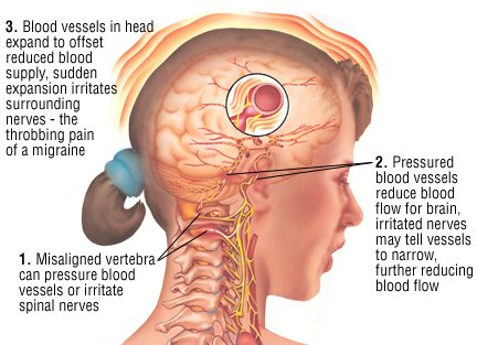 Migraine Guide: Causes, Symptoms and Treatment Options
