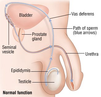 What causes low testosterone levels