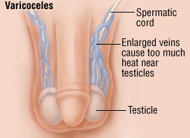 Low testosterone for men