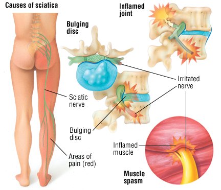 Consequences of low testosterone