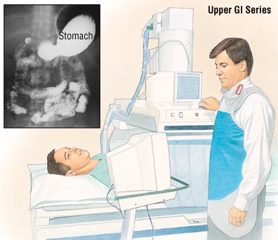 lump in upper stomach between ribs gastric cancer organization