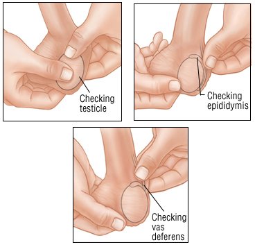 Testicular Cancer Lump. Testicular Cancer Guide: