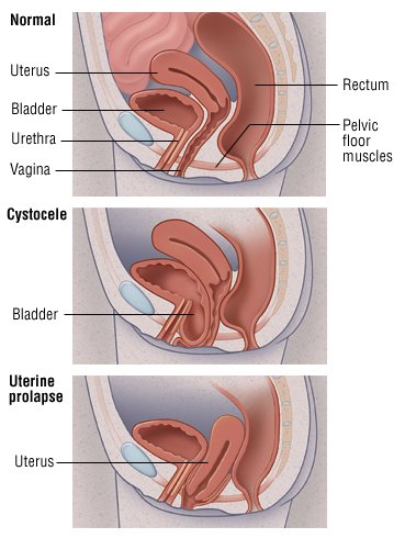 Uterine Orgasm 37