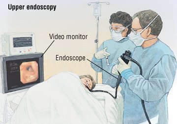 Picture Of Endoscopy