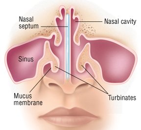 Nosebleed (EPISTAXIS) Guide: Causes, Symptoms and Treatment Options