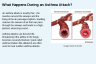What Happens During an Asthma Attack? What Happens During an Asthma Attack?