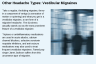 Other Headache Types: Vestibular Migraines Other Headache Types: Vestibular Migraines