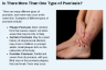 Is There More Than One Type of Psoriasis? Is There More Than One Type of Psoriasis?