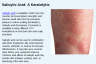 Salicylic Acid: A Keratolytic Salicylic Acid: A Keratolytic