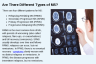 Are There Different Types of MS?