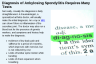 Diagnosis of Ankylosing Spondylitis Requires Many Tests Diagnosis of Ankylosing Spondylitis Requires Many Tests