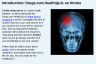 Introduction: Drugs.com HealthQuiz on Stroke
