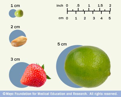 Brain Tumor Medications foto Brain Tumor Medications picture