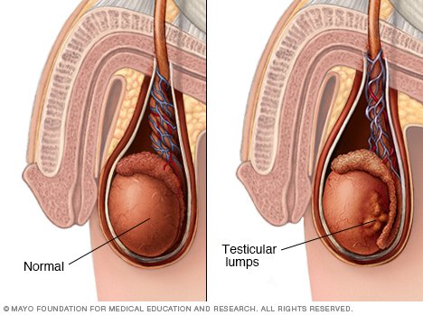 Sperm left testicle