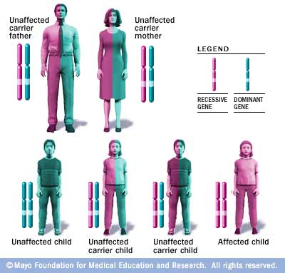 Wilson's disease Disease Reference Guide - Drugs.com