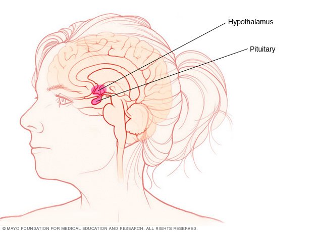 Watch Brain Tumor Risk Factors video Watch Brain Tumor Risk Factors video
