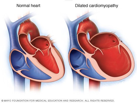 Discussion on this topic: Obesity is clot risk in pregnancy’, obesity-is-clot-risk-in-pregnancy/ Forum on this topic: Obesity is clot risk in pregnancy’, obesity-is-clot-risk-in-pregnancy/