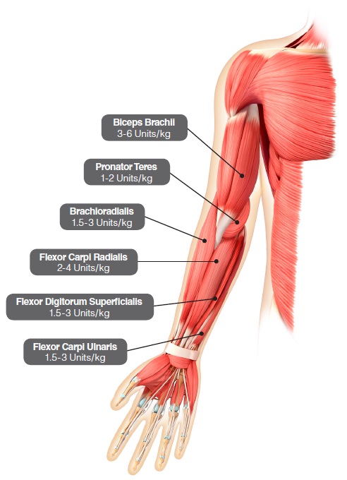 figure4_upper_limb_pediatric