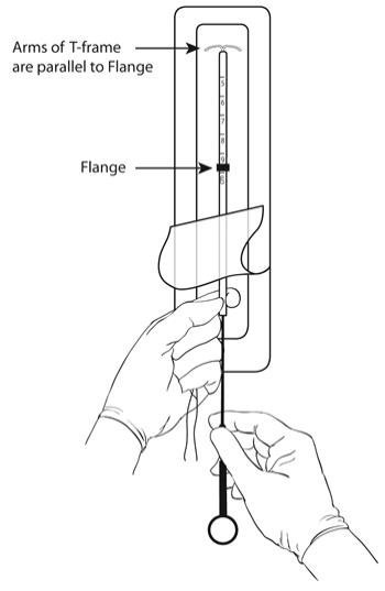Figure 4: Release the threads from the flange and insert the rod.