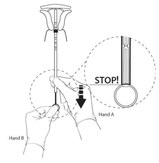 Figure 11: Hold the rod still and pull back the tube to the ring on the rod.