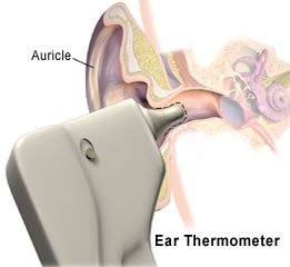 Picture of an ear thermometer