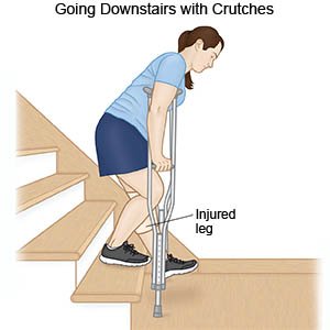 Crutches Going Downstairs with Crutches