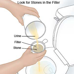 Look for Stones in the Filter
