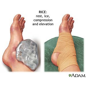 How easy is it to break an ankle?