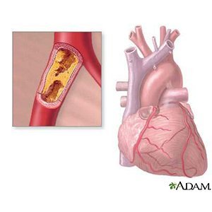 Can i lose weight in my arms image 9
