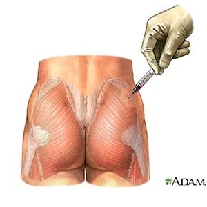 Resultado de imagem para intramuscular