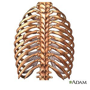 Rib Fracture Inpatient Care