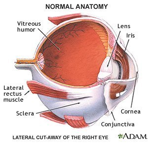 Diabetic Retinopathy - What You Need to Know