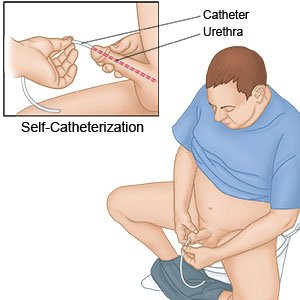 Self-Catheterization