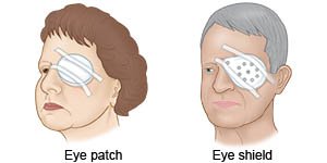 Eye Patch Eye Shield