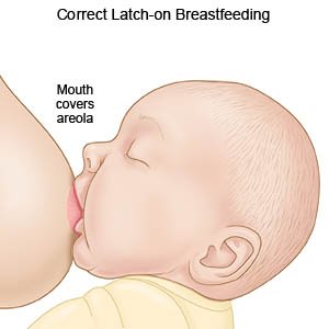 Correct Latch-on Breastfeeding 