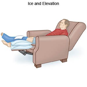 Ice and Elevation