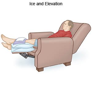 Ice and Elevation