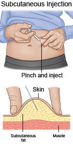 Subcutaneous Injection