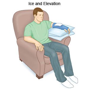 Ice and Elevation