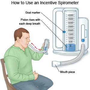 How to use and Incentive Spirometer