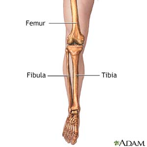 Leg Fracture Inpatient Care What You Need To Know