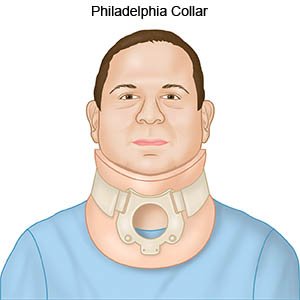 Philadelphia Collar