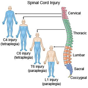 Spinal Cord Injury