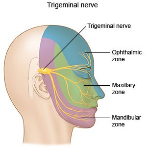 How do you alleviate pain caused by trigeminal neuralgia?