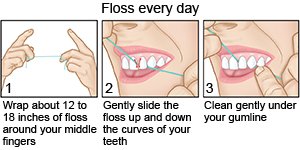 Floss every day