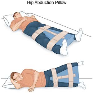 Post-surgical hip abduction pillows