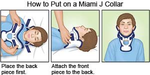 How to put on a Miami J Collar