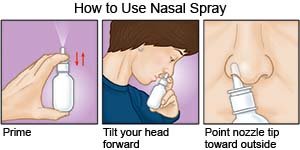 How to Use a Nasal Spray