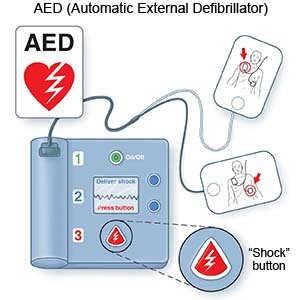 AED (Automatic External Defibrillator)